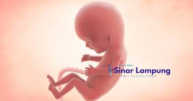 Kuliah di Jogja Mahasiswi Asal Bima Buang Bayi Orok di Bak Sampah