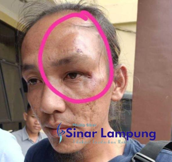 Wartawan Lubuk Linggau Babak Belur di Gebuki Anggota Brimob Kapolres Mediasi
