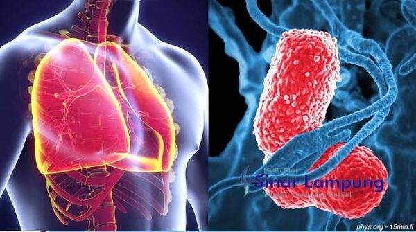 Paru-paru Basah Berbahaya ? Kenali Gejala dan Cara Pencegahannya
