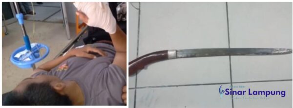 Jari Tangan Polisi Putus Dibabat Pekerja Steam