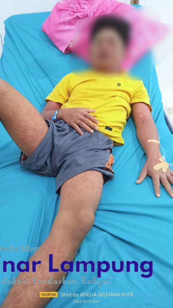 Akibat Alergi Obat 5 bulan Nando Membutuhkan Perhatian Pemerintah