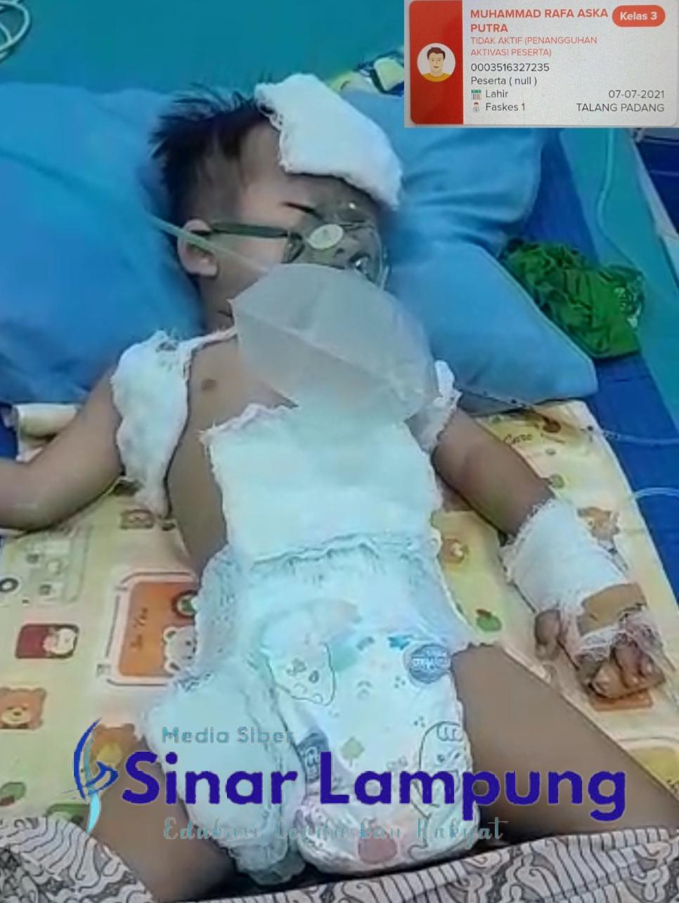 Rafa Terbaring Koma Butuh Perhatian Pemerintah dan Para Dermawan