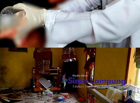 Tiga Warga di Palas Terluka Dihujani Pecahan Kaca Rumah Yang Disambar Petir