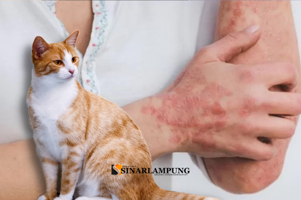 6 Penyakit Yang Ditularkan Kucing Ke Manusia