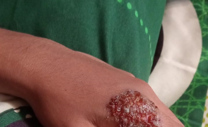 Pak Bu Waspadalah, Kamitetep Mengintai Rumah Anda