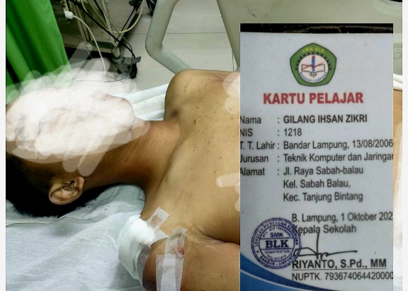 Tawuran di Jalan Depan SMA Negeri 5 Satu Pelajar SMK BLK Tewas