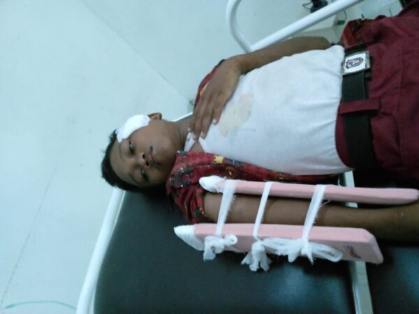 Berangkat Sekolah Bocah SD di Begal di Pesawaran Korban Cidera Patah Tangan