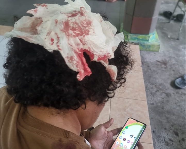 Istri Pj Bupati Mimika Diduga Aniaya Dua ASN?