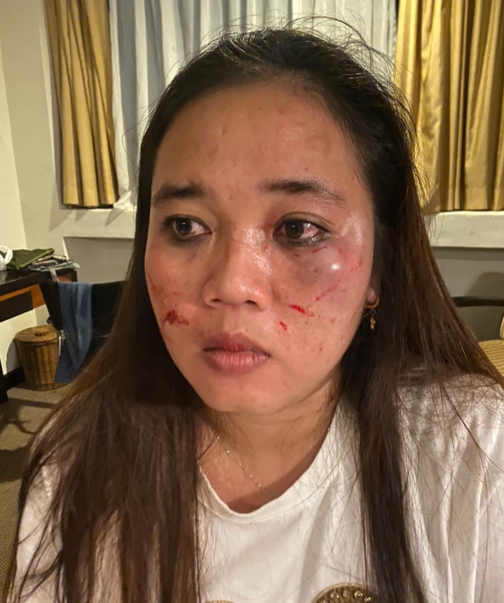 Keluarga Terlapor Penganiayaan Datang ke Rumah Korban Minta Maaf dan Ajak Berdamai