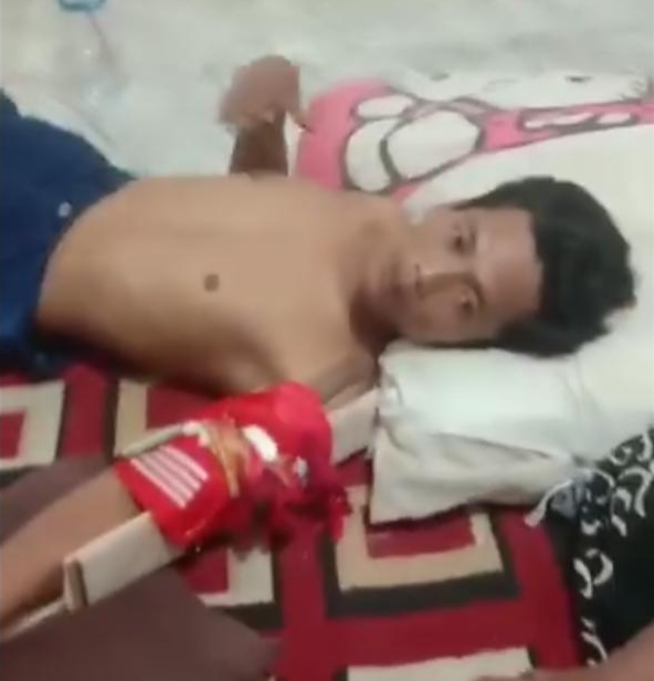 Supir Truck Patah Tulang Usai Dianiaya Preman di Lampung Tengah