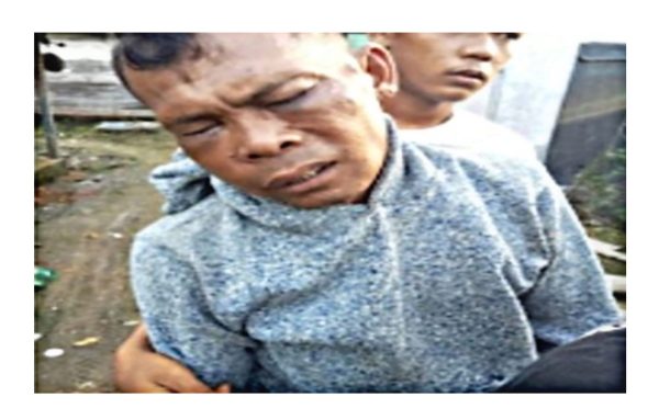 Pria di Muba Babak Belur Dikeroyok Istri dan Anak Tiri