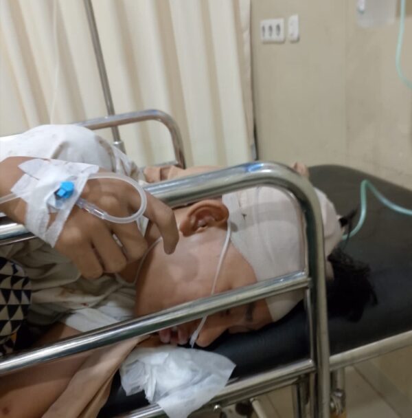 Korban Geng Motor di Bandar Lampung Alami Koma, Keluarga Minta Pelaku Segera Ditangkap