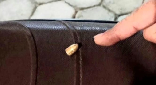 Lagi, Warga Bandar Lampung Kena Peluru Nyasar