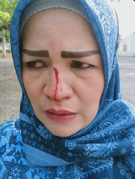 Juwita Korban Penganiayaan Pertanyakan Kinerja Polres Tulang Bawang