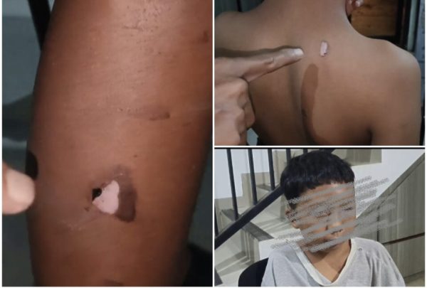 Oknum Ustaz Pengasuh Ponpes Modern Pesona Al-Quran Negeri Sakti Aniaya Satri 13 Tahun Babak Belur Hingga Luka Bakar Ditempel Besi Panas?