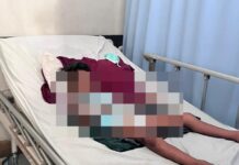 Siswa Kelas 1 SD di Seruni Mumbul Diduga Alami Patah Tulang akibat Perundungan